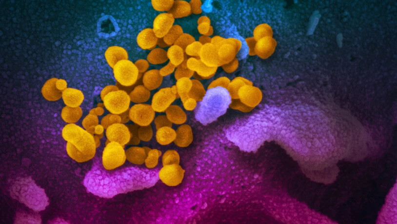 Das ist der Urheber der Lungenkrankheit: Das neuartige Coronavirus unter dem Mikroskop.