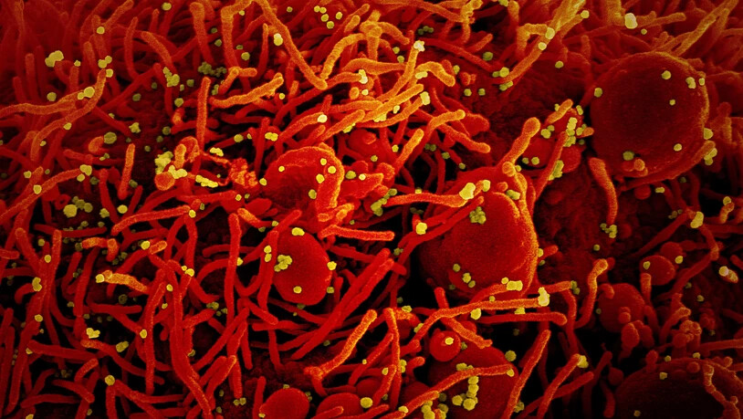 ARCHIV - Eine Zelle (rot) mit dem Coronavirus (SARS-CoV-2, gelb) infiziert. Foto: National Institute of Allergy and Infectious Diseases/Europa Press/dpa - ACHTUNG: Nur zur redaktionellen Verwendung und nur mit vollständiger Nennung des vorstehenden…