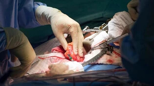 Dank des Fortschritts in der Medizin können Organtransplantationen immer erfolgreicher durchgeführt werden.