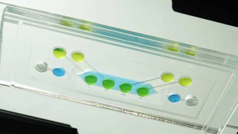 Der an der ETH entwickelte Testchip für Medikamente mit hängenden Nährstofflösungen, von unten betrachtet. Er schaltet zwischen das mütterliche Blut (blaue Tropfen) und das embryonale (grün) eine Plazentaschranke (blaues Feld). (Pressebild)